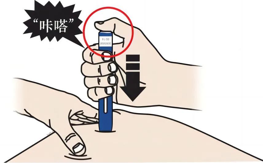 降脂药依洛尤单抗，要怎么使用?(图8)